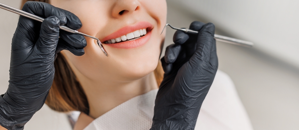 no prep veneers cost
