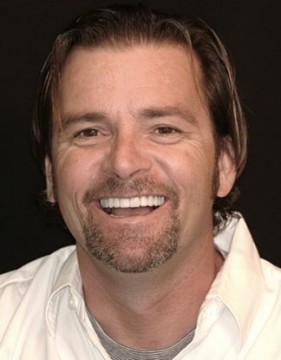 After new dental crowns and veneers by James B Polley of Summerlin this patient received a smile he was proud of